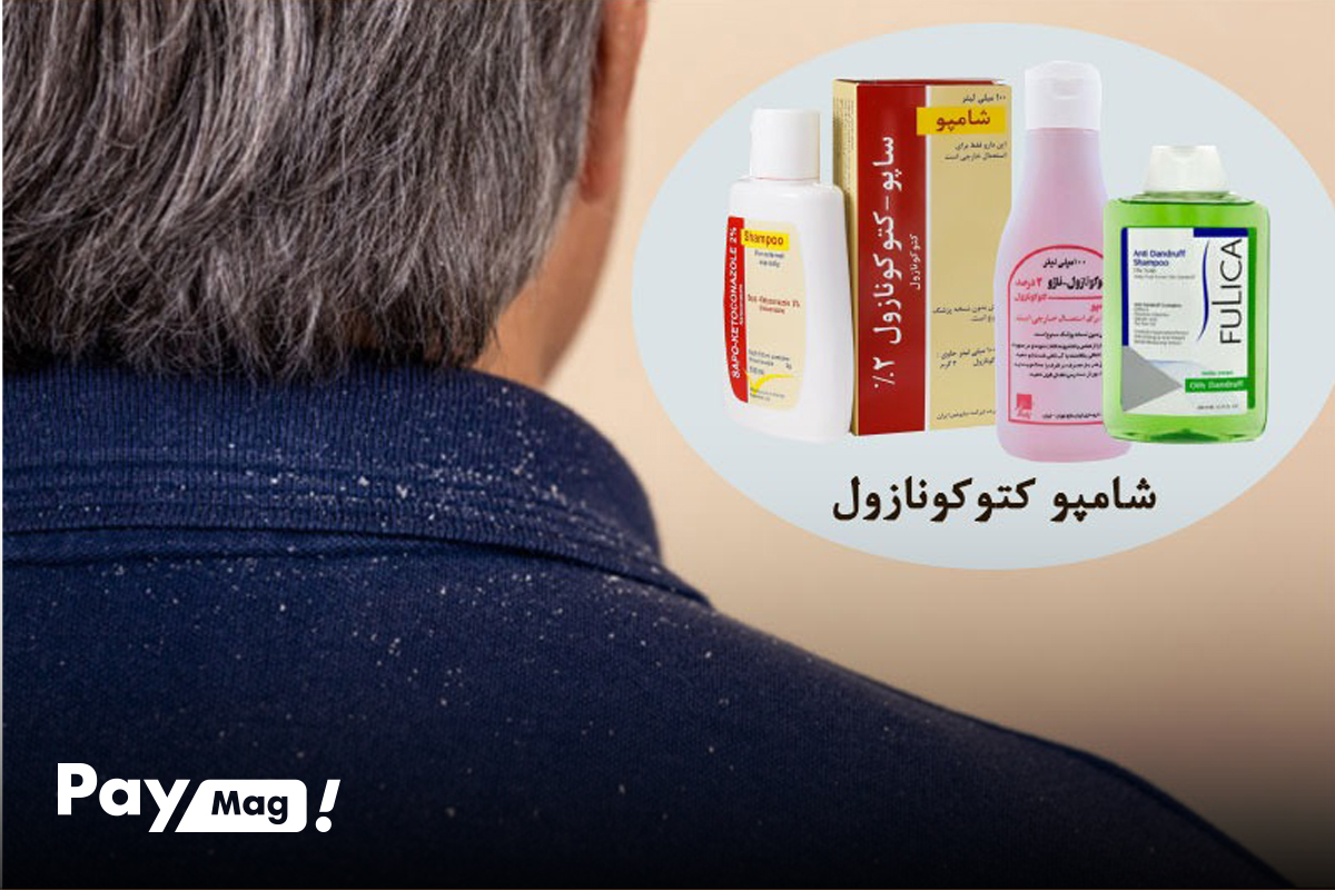 شامپوهای کتوکونازول