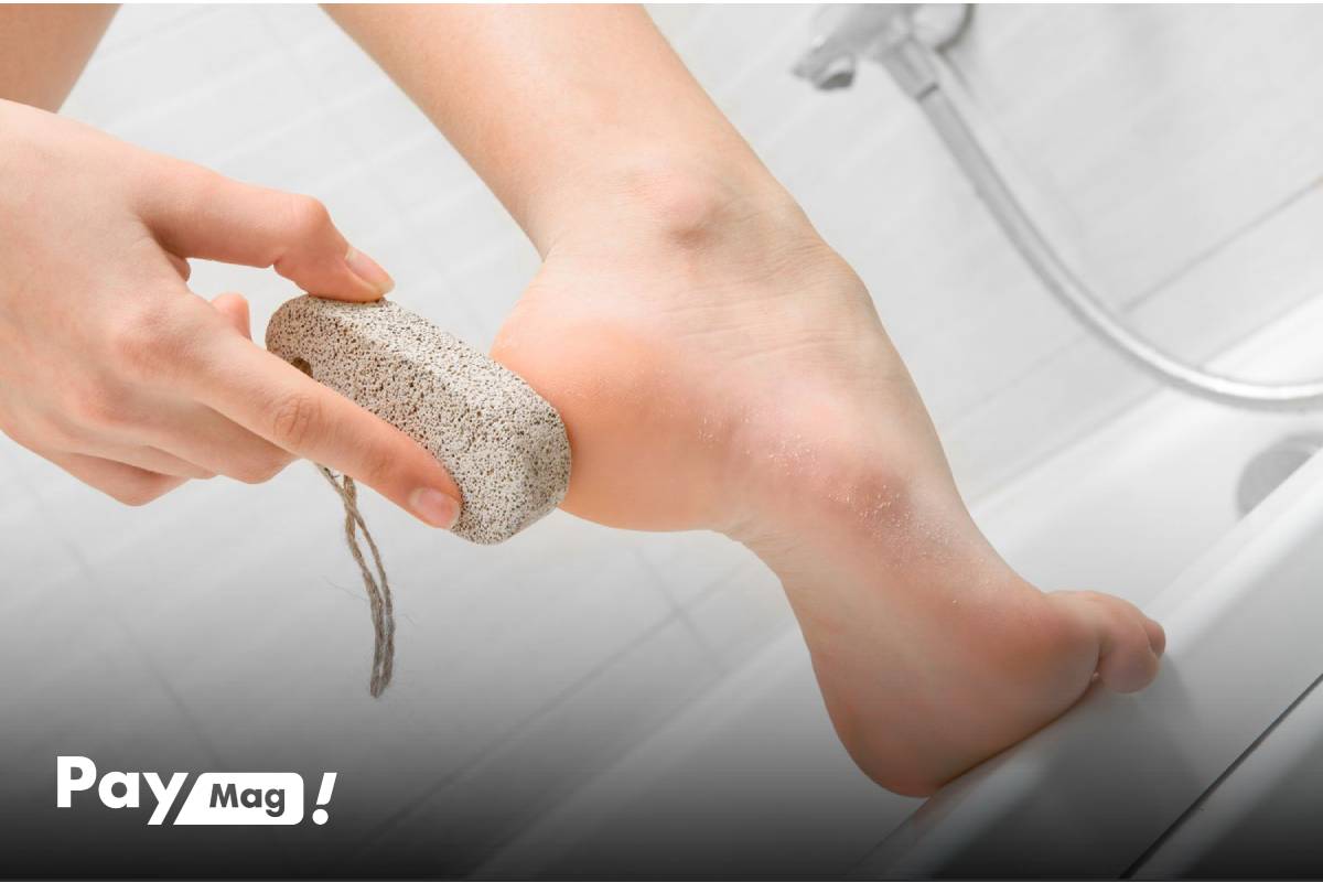 علت میخچه پا