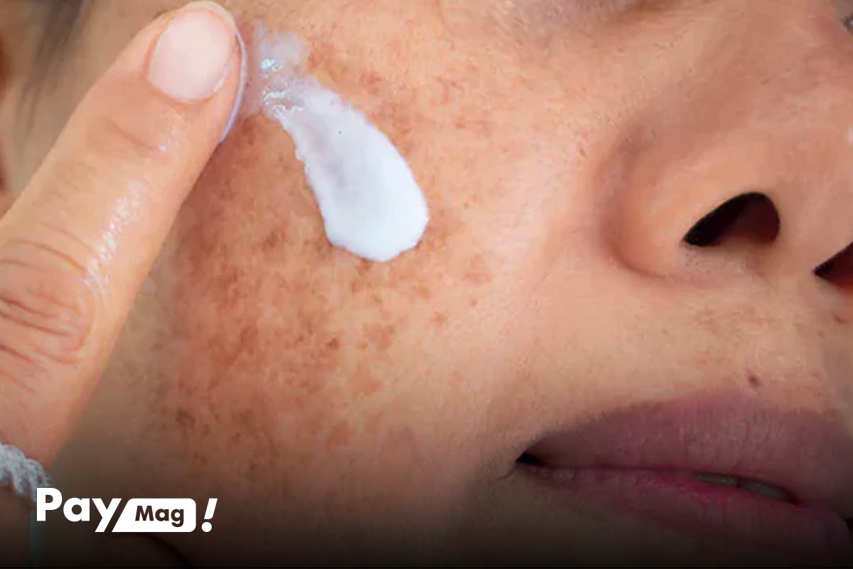 قیمت پماد هیدروکورتیزون برای لک صورت