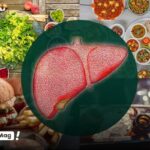 لیست بهترین مواد غذایی مفید برای درمان کبد چرب